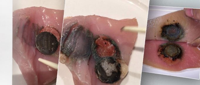 Что делать если ребенок проглотил батарейку